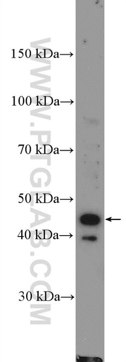 CD94 Rabbit anti-Human, Polyclonal, Proteintech:Antibodies:Primary Antibodies
