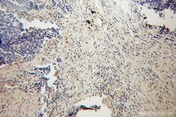 HK3 Rabbit anti-Human, Mouse, Rat, Polyclonal, Proteintech:Antibodies:Primary