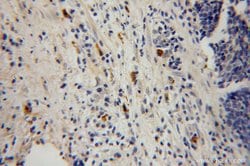 HK3 Rabbit anti-Human, Mouse, Rat, Polyclonal, Proteintech:Antibodies:Primary