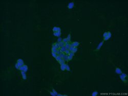 PPP3CB Rabbit anti-Human, Mouse, Rat, Polyclonal, Proteintech:Antibodies:Primary