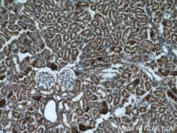 PPP3CB Rabbit anti-Human, Mouse, Rat, Polyclonal, Proteintech:Antibodies:Primary
