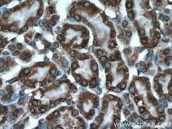 PPP3CB Rabbit anti-Human, Mouse, Rat, Polyclonal, Proteintech:Antibodies:Primary