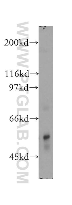 PPP3CB Rabbit anti-Human, Mouse, Rat, Polyclonal, Proteintech:Antibodies:Primary