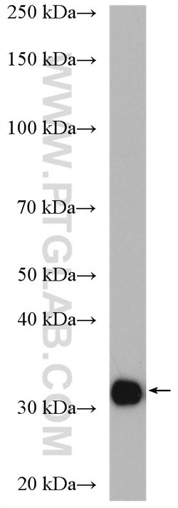 CA5B Rabbit anti-Human, Mouse, Rat, Polyclonal, Proteintech 150 &mu;L;
