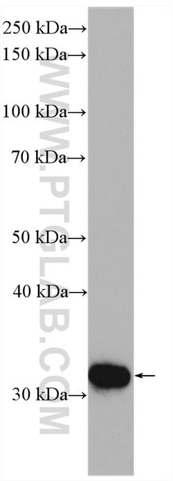 CA5B Rabbit anti-Human, Mouse, Rat, Polyclonal, Proteintech 150 &mu;L;