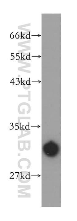 CA5B Rabbit anti-Human, Mouse, Rat, Polyclonal, Proteintech 150 &mu;L;