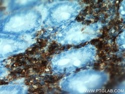 TPSAB1 Rabbit anti-Human, Mouse, Rat, Polyclonal, Proteintech 150 &mu;L;