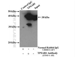 TPSAB1 Rabbit anti-Human, Mouse, Rat, Polyclonal, Proteintech 150 &mu;L;