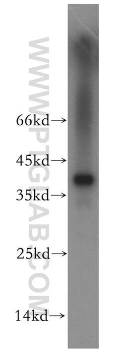 TPSAB1 Rabbit anti-Human, Mouse, Rat, Polyclonal, Proteintech 150 &mu;L;