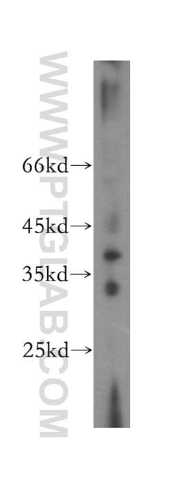 TPSAB1 Rabbit anti-Human, Mouse, Rat, Polyclonal, Proteintech 150 &mu;L;