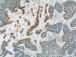 PLA2G4D Rabbit anti-Human, Mouse, Polyclonal, Proteintech:Antibodies:Primary