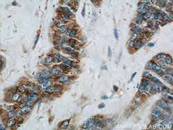 PLA2G4D Rabbit anti-Human, Mouse, Polyclonal, Proteintech:Antibodies:Primary