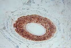 PLA2G4D Rabbit anti-Human, Mouse, Polyclonal, Proteintech:Antibodies:Primary