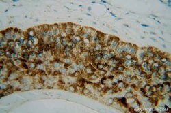 PLA2G4D Rabbit anti-Human, Mouse, Polyclonal, Proteintech:Antibodies:Primary