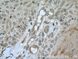 PLA2G4D Rabbit anti-Human, Mouse, Polyclonal, Proteintech:Antibodies:Primary
