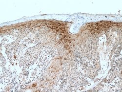 PLA2G4D Rabbit anti-Human, Mouse, Polyclonal, Proteintech:Antibodies:Primary