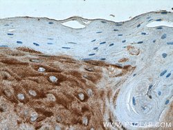 PLA2G4D Rabbit anti-Human, Mouse, Polyclonal, Proteintech:Antibodies:Primary