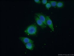 GNA14 Rabbit anti-Human, Mouse, Polyclonal, Proteintech:Antibodies:Primary