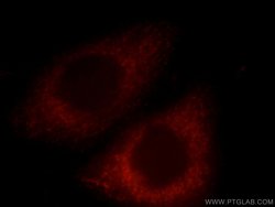GNA14 Rabbit anti-Human, Mouse, Polyclonal, Proteintech:Antibodies:Primary