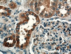 GNA14 Rabbit anti-Human, Mouse, Polyclonal, Proteintech:Antibodies:Primary