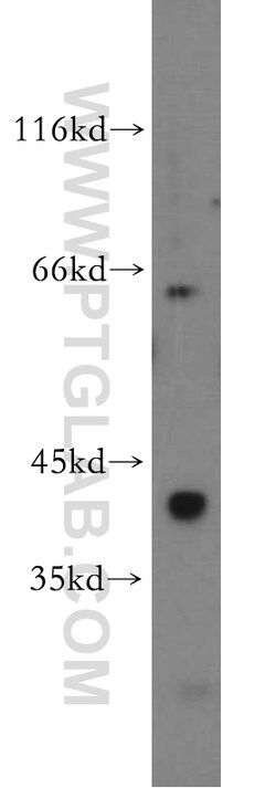 GNA14 Rabbit anti-Human, Mouse, Polyclonal, Proteintech:Antibodies:Primary