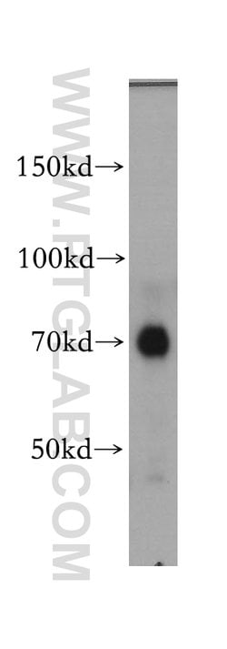 IL10RA Rabbit anti-Human, Polyclonal, Proteintech:Antibodies:Primary Antibodies