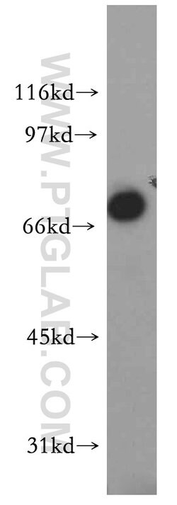 IL10RA Rabbit anti-Human, Polyclonal, Proteintech:Antibodies:Primary Antibodies