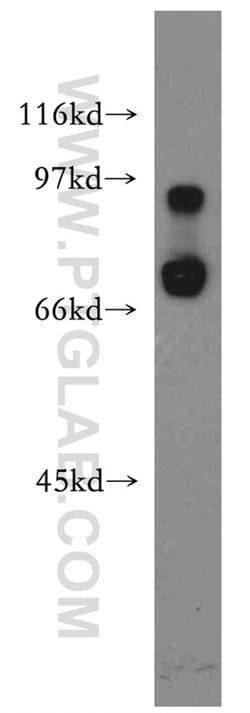 IL10RA Rabbit anti-Human, Polyclonal, Proteintech:Antibodies:Primary Antibodies