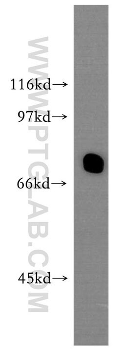 IL10RA Rabbit anti-Human, Polyclonal, Proteintech:Antibodies:Primary Antibodies