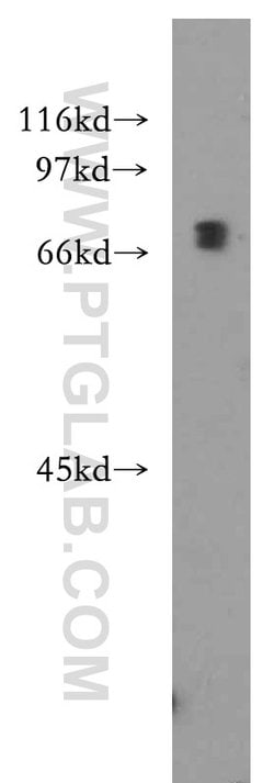 IL10RA Rabbit anti-Human, Polyclonal, Proteintech:Antibodies:Primary Antibodies