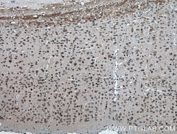 TDRD3 Rabbit anti-Human, Mouse, Rat, Polyclonal, Proteintech:Antibodies:Primary