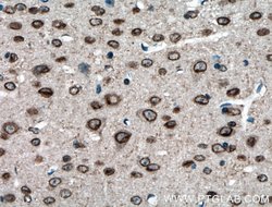 TDRD3 Rabbit anti-Human, Mouse, Rat, Polyclonal, Proteintech:Antibodies:Primary