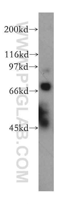 TDRD3 Rabbit anti-Human, Mouse, Rat, Polyclonal, Proteintech:Antibodies:Primary