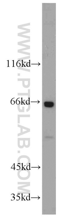 Glycerokinase Rabbit anti-Human, Mouse, Rat, Polyclonal, Proteintech 150