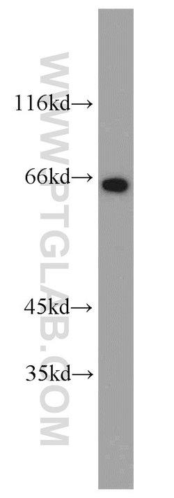 Glycerokinase Rabbit anti-Human, Mouse, Rat, Polyclonal, Proteintech 150