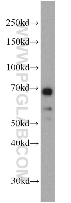 Glycerokinase Rabbit anti-Human, Mouse, Rat, Polyclonal, Proteintech 150