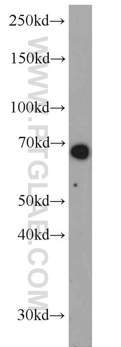 Glycerokinase Rabbit anti-Human, Mouse, Rat, Polyclonal, Proteintech 150