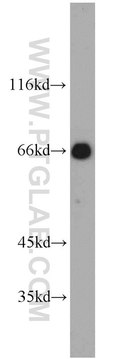 Glycerokinase Rabbit anti-Human, Mouse, Rat, Polyclonal, Proteintech 150