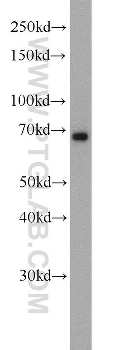 Glycerokinase Rabbit anti-Human, Mouse, Rat, Polyclonal, Proteintech 150