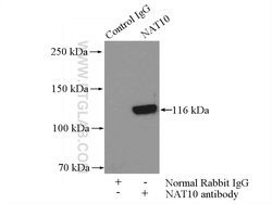 NAT10 Rabbit anti-Human, Mouse, Rat, Polyclonal, Proteintech:Antibodies:Primary