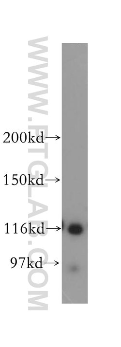 NAT10 Rabbit anti-Human, Mouse, Rat, Polyclonal, Proteintech:Antibodies:Primary