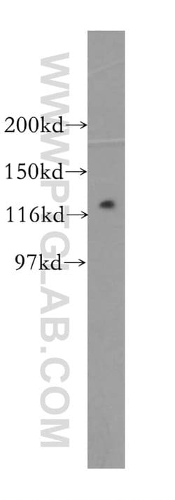PPP1R12B Rabbit anti-Human, Mouse, Rat, Polyclonal, Proteintech 150 &mu;L;