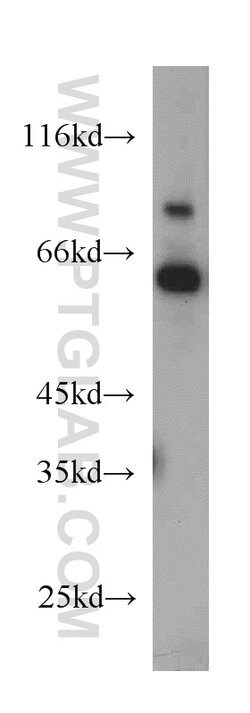 TDG Rabbit anti-Human, Mouse, Rat, Polyclonal, Proteintech:Antibodies:Primary