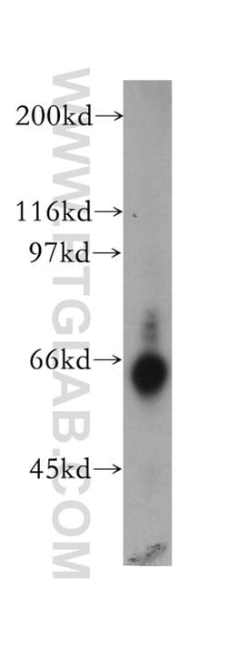 TDG Rabbit anti-Human, Mouse, Rat, Polyclonal, Proteintech:Antibodies:Primary