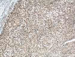 PARP1 Rabbit anti-Human, Mouse, Rat, Polyclonal, Proteintech:Antibodies:Primary