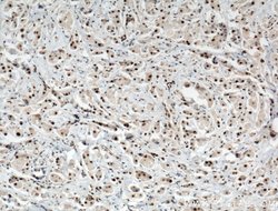PARP1 Rabbit anti-Human, Mouse, Rat, Polyclonal, Proteintech:Antibodies:Primary