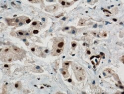 PARP1 Rabbit anti-Human, Mouse, Rat, Polyclonal, Proteintech:Antibodies:Primary