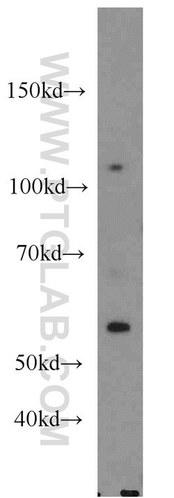 PARP1 Rabbit anti-Human, Mouse, Rat, Polyclonal, Proteintech:Antibodies:Primary