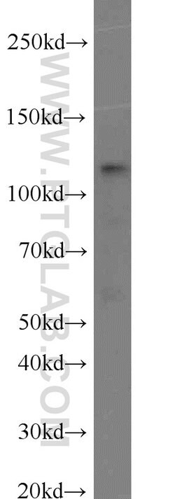 PARP1 Rabbit anti-Human, Mouse, Rat, Polyclonal, Proteintech:Antibodies:Primary