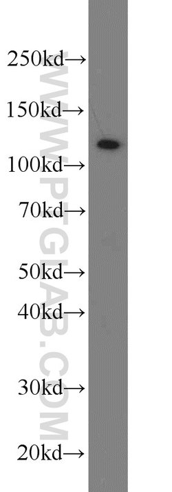 PARP1 Rabbit anti-Human, Mouse, Rat, Polyclonal, Proteintech:Antibodies:Primary